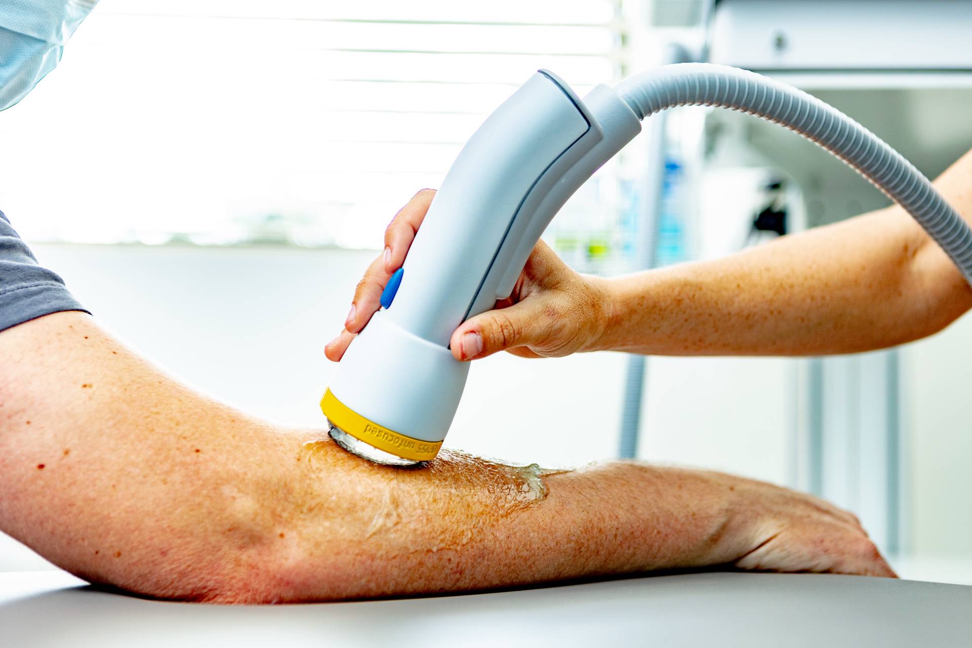 Softwave shockwave therapy device on patient